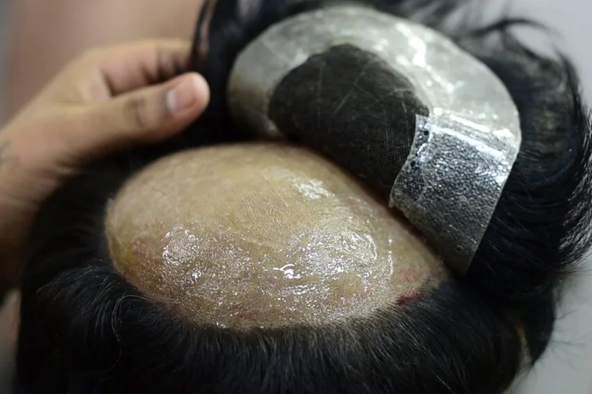 flairhair-hair patch and wigs
