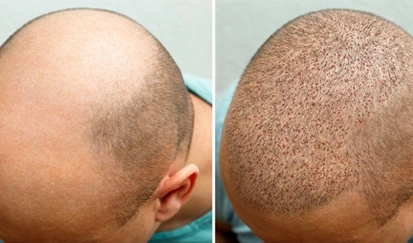 flairhair fue-fut section image