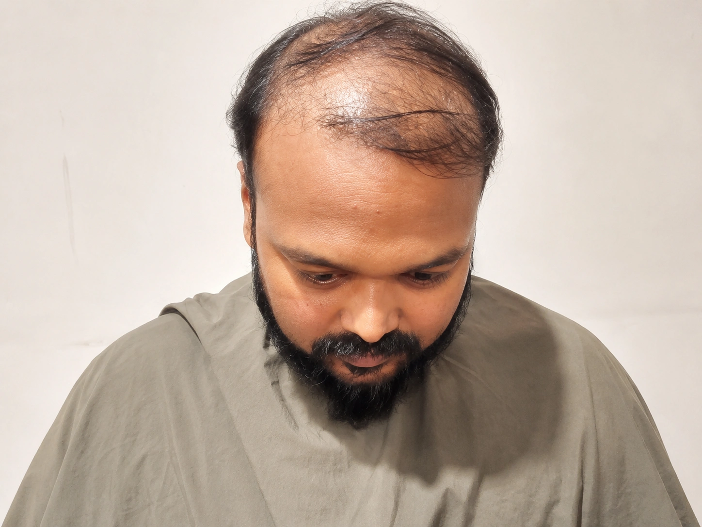 Before Photo - Two - Flairhair